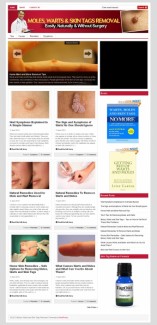 Moles, Warts And Skin Removal Plr Niche Blog PLR Template