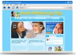 Teeth Whitening Blog Theme Personal Use Template