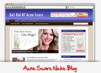 Acne Scars Niche Blog Personal Use Template