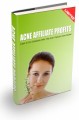 Acne Affiliate Profits Resale Rights Ebook With Video