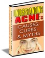Understanding Acne: Causes, Cures,  Myths Resale Rights ...