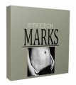 Stretch Marks Niche Website Bundle Personal Use Template 
