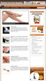 Plantar Fasciitis Niche Blog Personal Use Template With Video