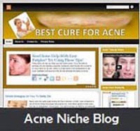 Acne Niche Blog Personal Use Template