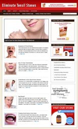 Tonsil Stones Niche Blog Personal Use Template With Video